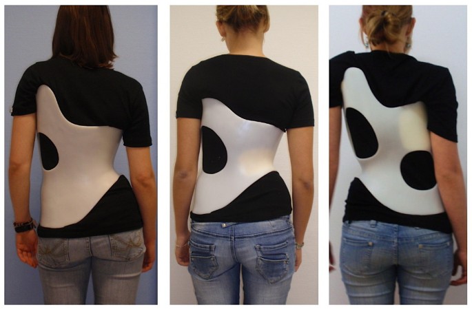 Spinal brace