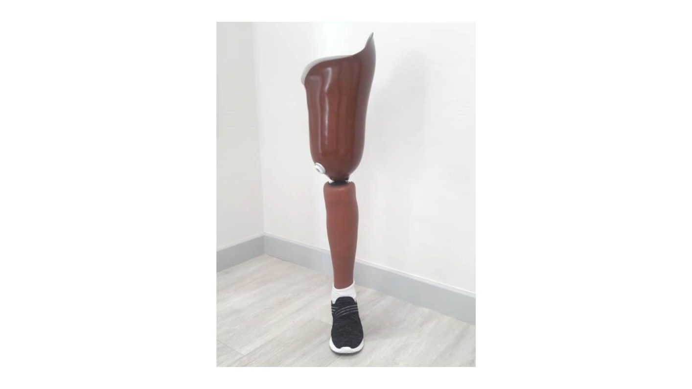 Above-knee prosthesis with sneaker