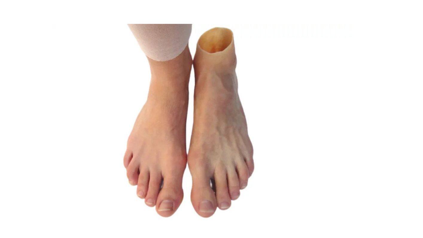 Partial foot prosthesis